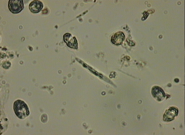 Dictyocha speculum